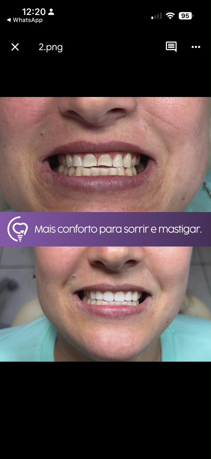 Transformação Sutil